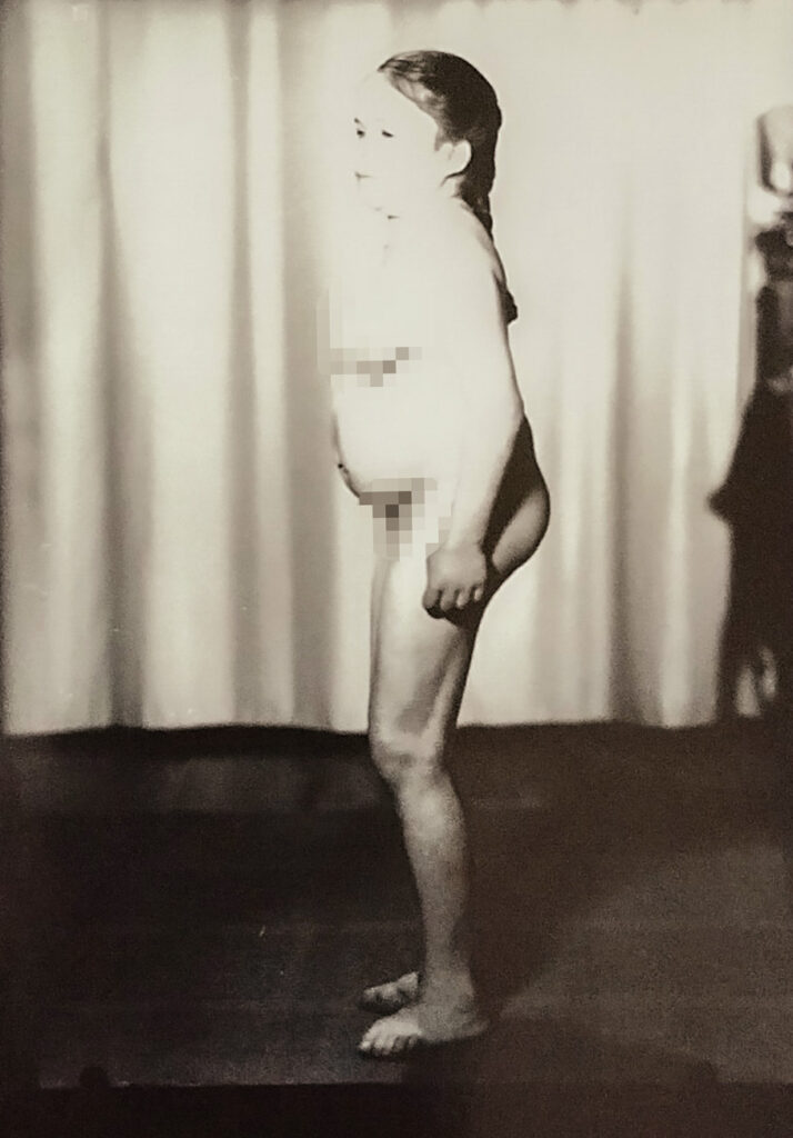 Es ist ein schwarz-weißes Foto. Zu sehen ist ein nacktes Mädchen. Es ist von der Seite aufgenommen. Sie steht seitlich zur Kamera. Ihr Stand wirkt unsicher. Ihre Füße sind nach außen gestellt. Sie trägt einen geflochtenen Zopf. Hinter ihm ist ein Bühnenvorhang zu erkennen.